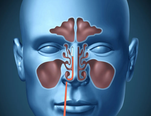 Balloons Up Your Nose? Learn About Sinuplasty