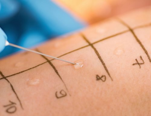 Why Allergy Testing Matters
